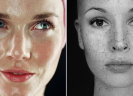 BẠN CÓ THỂ CÓ CẢ DA KHÔ VÀ DA NHỜN CÙNG MỘT LÚC KHÔNG?