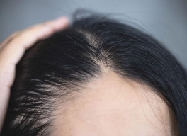 NGUYÊN NHÂN VÀ CÁCH KHẮC PHỤC TÓC HÓI, TÓC THƯA HIỆU QUẢ