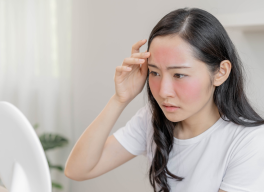 NHỮNG MÓN ĂN CÀNG ĂN CÀNG GÂY MỤN TRỨNG CÁ KHIẾN DA XẤU ĐI